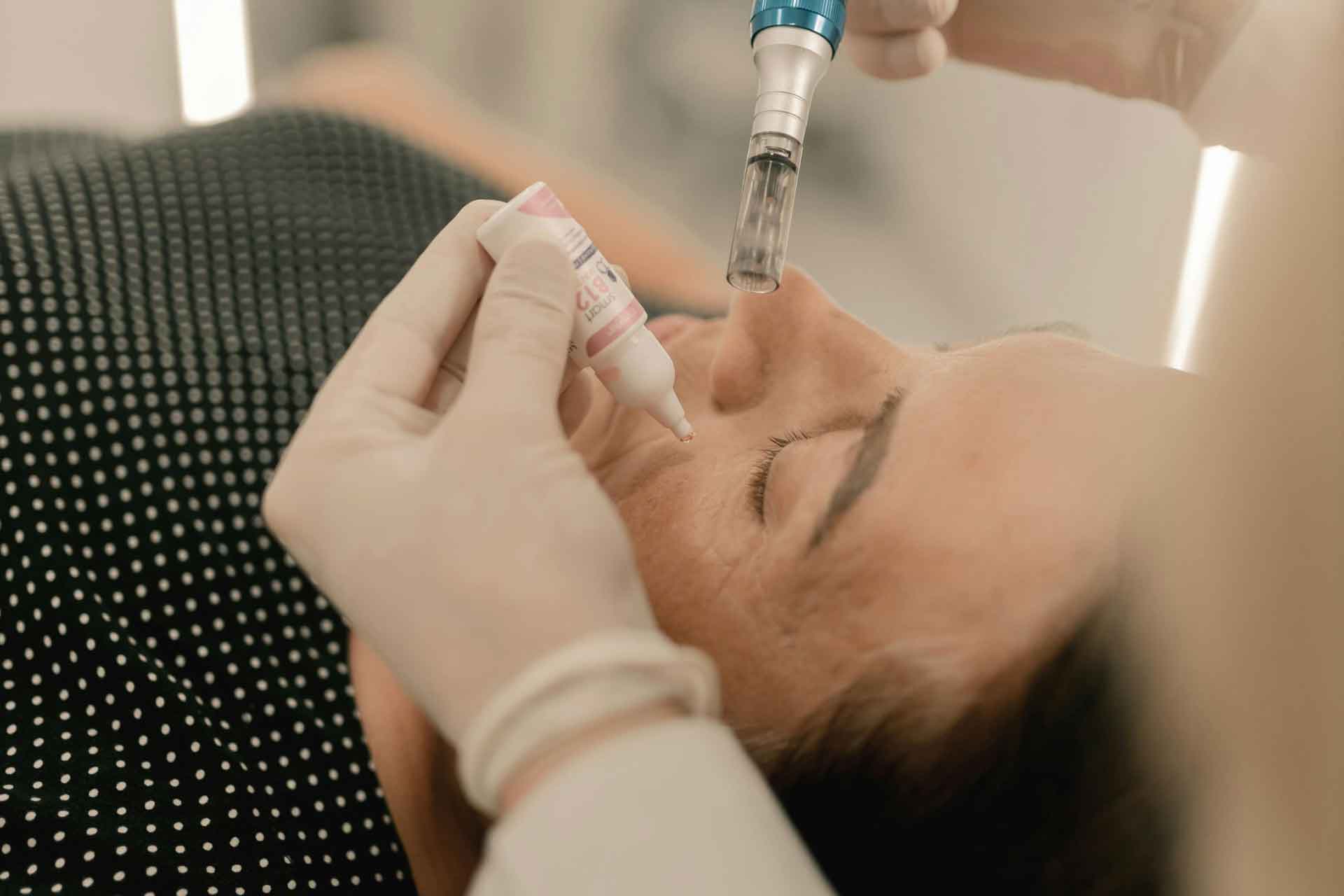 bellatec-microneedling-figueres-tratamiento-facial